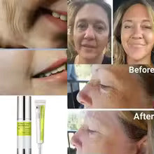 Retinal Shot Tightening Booster (Original) COD In UAE Only Fast Delivery 1 to 3 DAYs