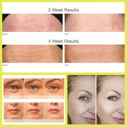 Retinal Shot Tightening Booster (Original) COD In UAE Only Fast Delivery 1 to 3 DAYs