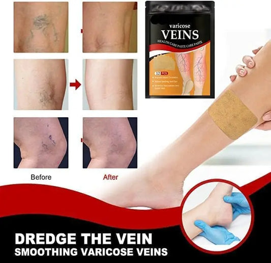 Hanel - Varicose Veins Patch (Original) - 07BM