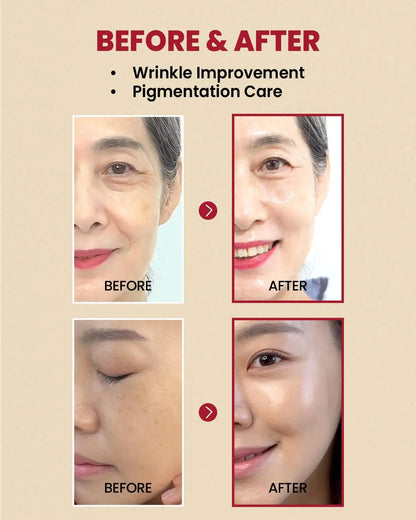 K‑SECRET - SEOUL 1988 Serum: Retinal Liposome 2% + Black Ginseng (Original) - 07BM