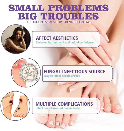 Nail Fungus Spray Original - 07BM