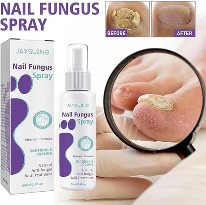 Nail Fungus Spray Original - 07BM