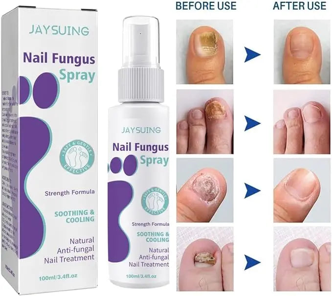 Nail Fungus Spray Original - 07BM