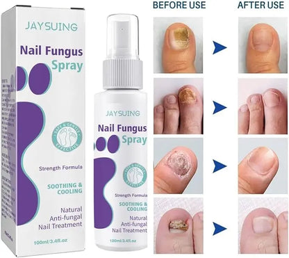 Nail Fungus Spray Original - 07BM