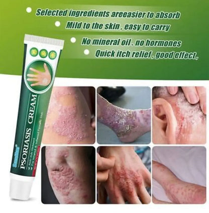 Summifun - Psoriasis Cream (Original) - 07BM