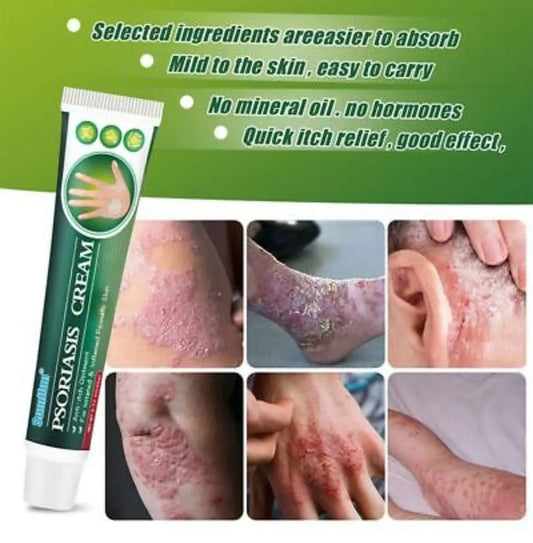 Summifun - Psoriasis Cream (Original) - 07BM